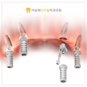 온천동치과